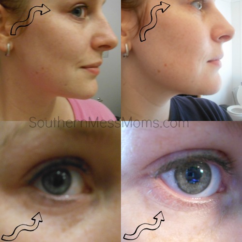 NeriumAD results
